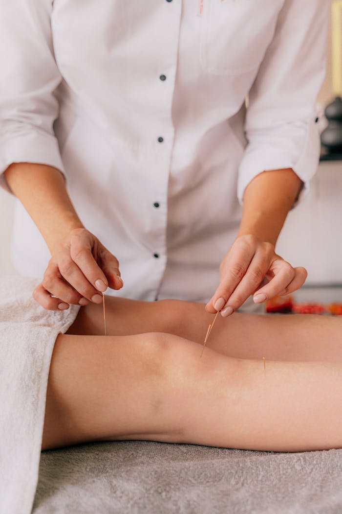 Close-up of professional performing acupuncture on a client