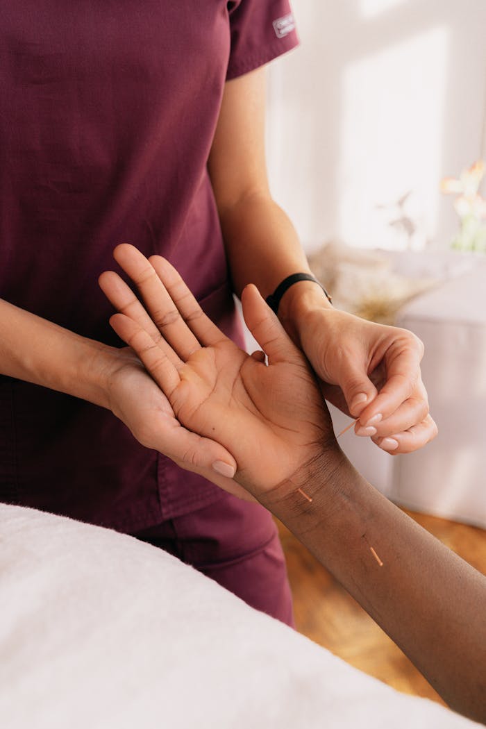 Close-up of hands performing acupuncture therapy on a patient in a spa setting.