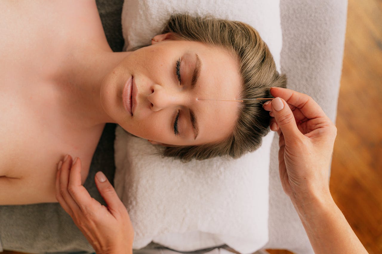 Serene acupuncture treatment focusing on relaxation and wellness in a spa setting.