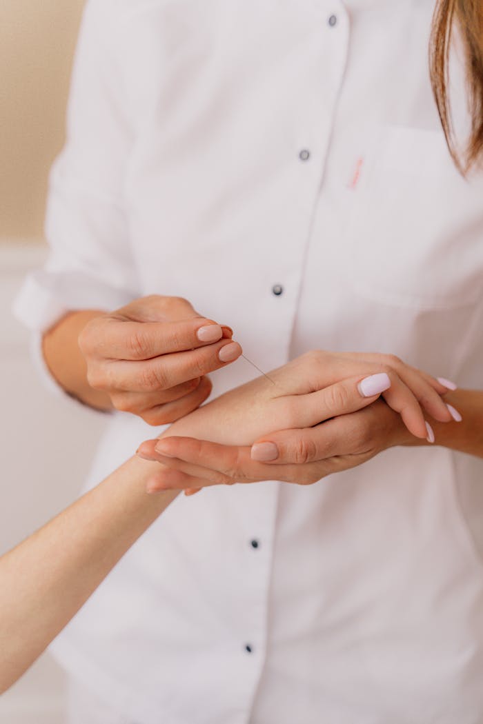 Acupuncturist carefully inserting needles into a patient