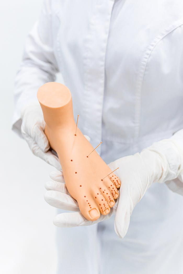 Close-up of a practitioner using acupuncture needles on a foot model for alternative therapy.