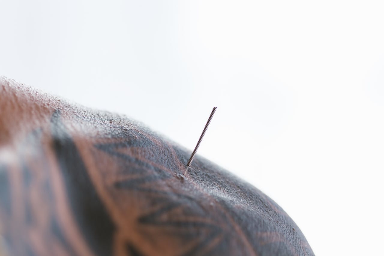 A detailed close-up of an acupuncture needle on tattooed skin, highlighting alternative medicine.